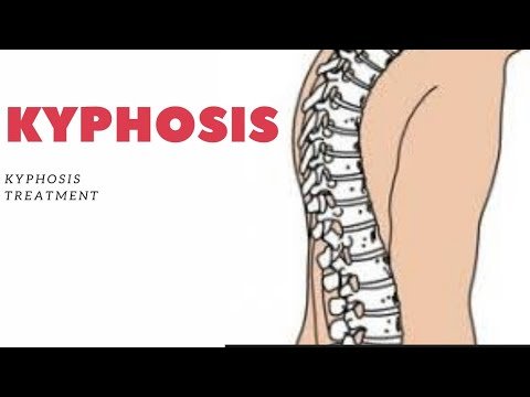 أفضل التمارين المنزلية لعلاج تقوس الظهر وتعديل قوام العمود الفقري