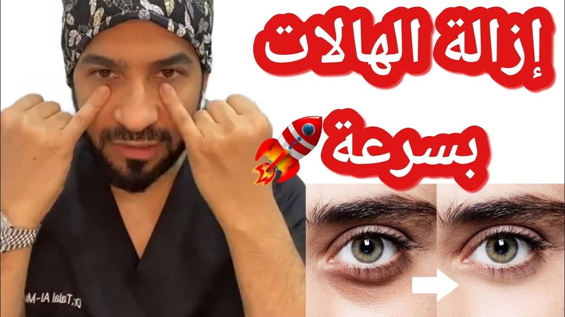 كيفية علاج الهالات السوداء تحت العين نهائياً بوصفات منزلية مجربة