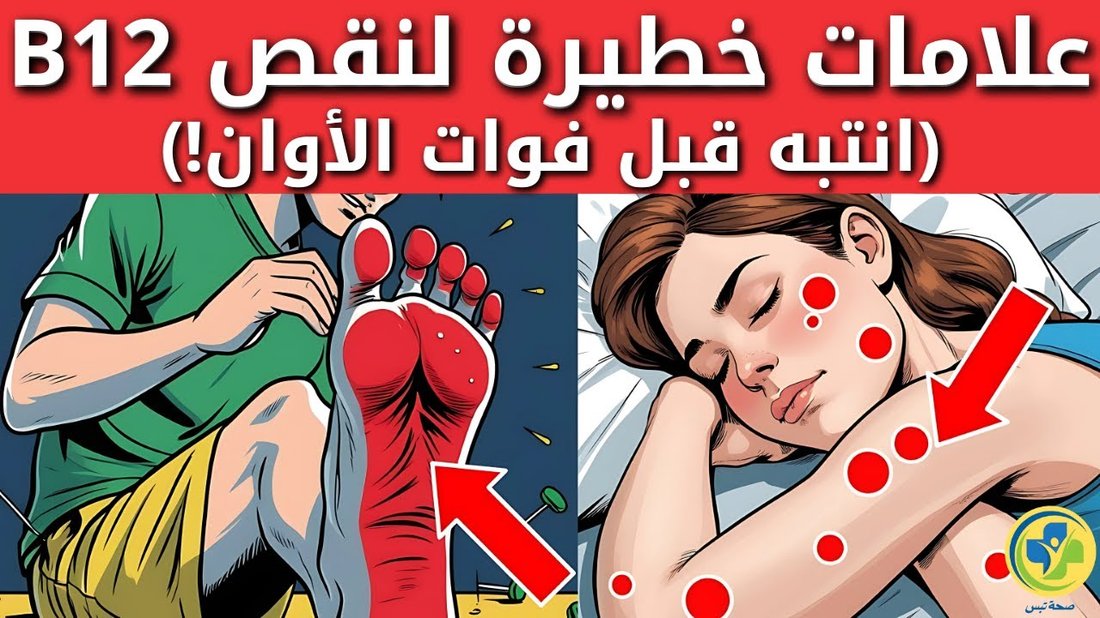 علامات خفية لنقص فيتامين د يتم الخلط بينها وبين التعب المزمن