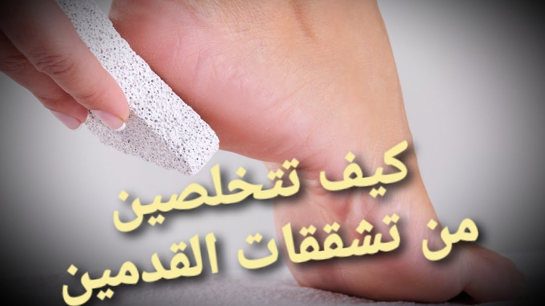 كيف تعالج تشققات القدمين في ليلة واحدة وتستعيد نعومتهما