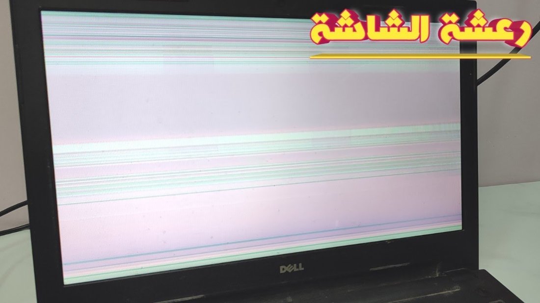 أسباب رعشة اليد في سن الشباب ومتى يجب استشارة الطبيب المختص