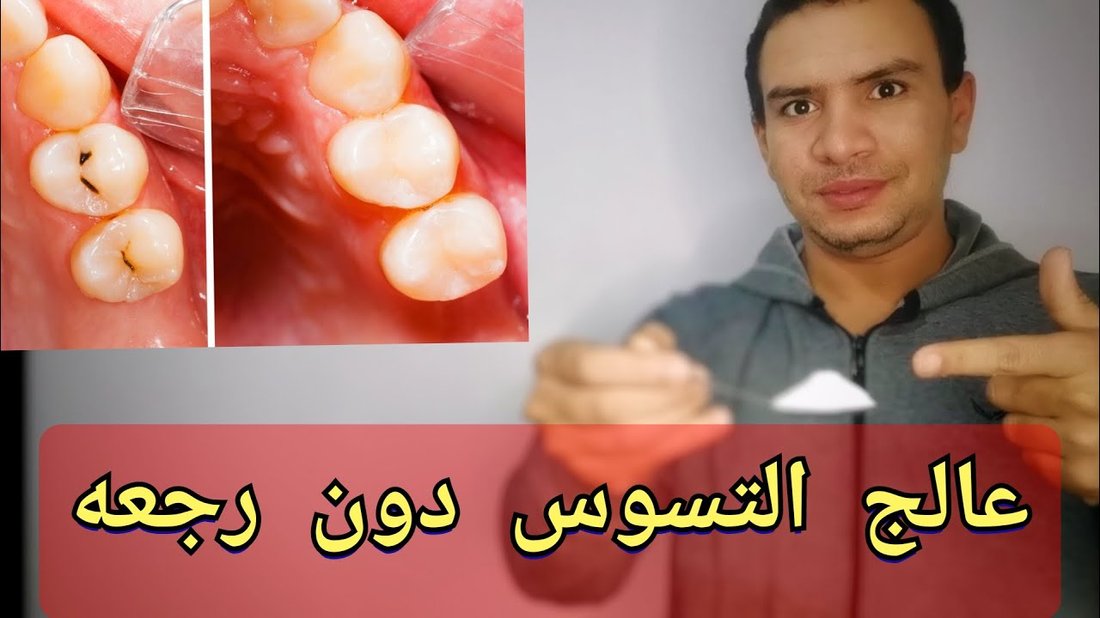 أفضل الطرق الطبيعية لتبييض الأسنان في المنزل دون إلحاق ضرر بالمينا