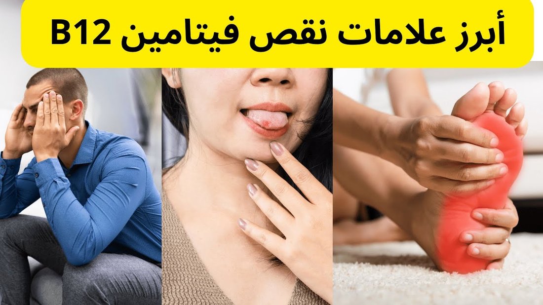 علامات نقص فيتامين د التي يتجاهلها معظم الناس